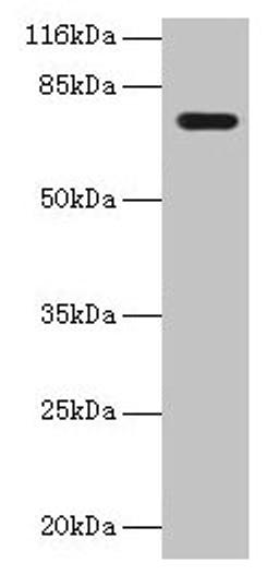 Western blot. All lanes: KBTBD2 antibody at 2µg/ml + A549 whole cell lysate. Secondary. Goat polyclonal to rabbit IgG at 1/10000 dilution. Predicted band size: 72 kDa. Observed band size: 72 kDa