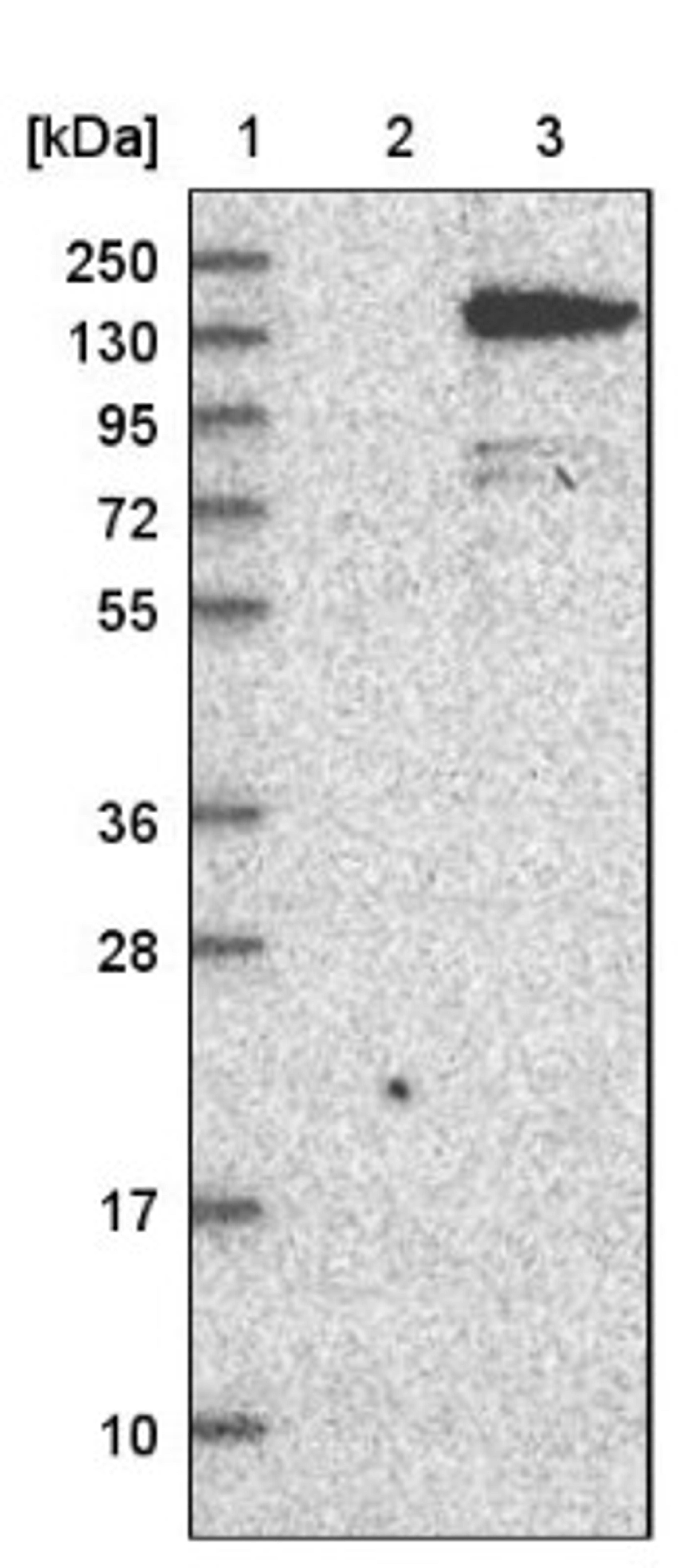 Western Blot: ALPK1 Antibody [NBP1-83594] - Lane 1: Marker [kDa] 250, 130, 95, 72, 55, 36, 28, 17, 10<br/>Lane 2: Negative control (vector only transfected HEK293T lysate)<br/>Lane 3: Over-expression lysate (Co-expressed with a C-terminal myc-DDK tag (~3.1 kDa) in mammalian HEK293T cells, LY403053)