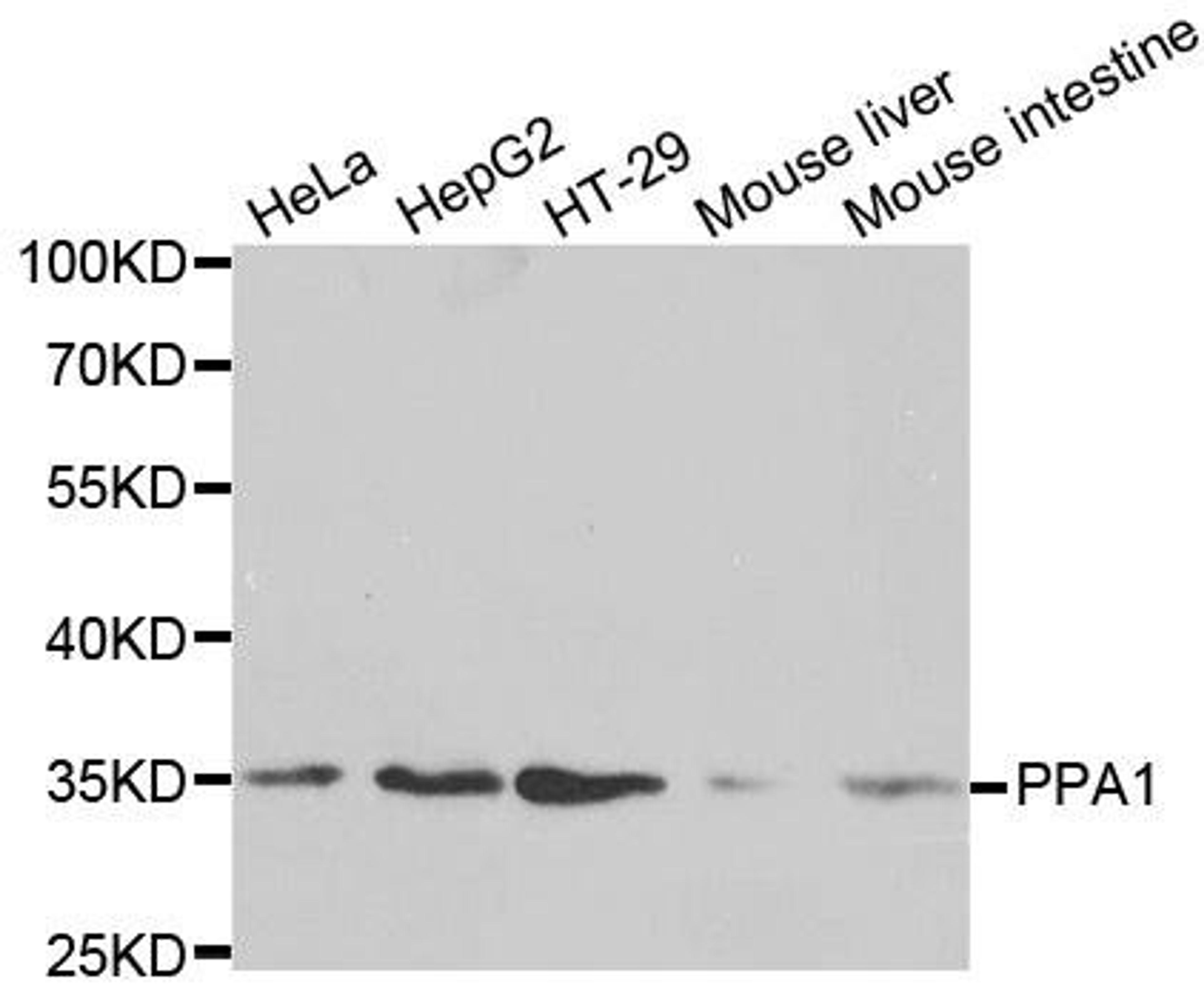 Western blot analysis of extracts of various cell lines using PPA1 antibody