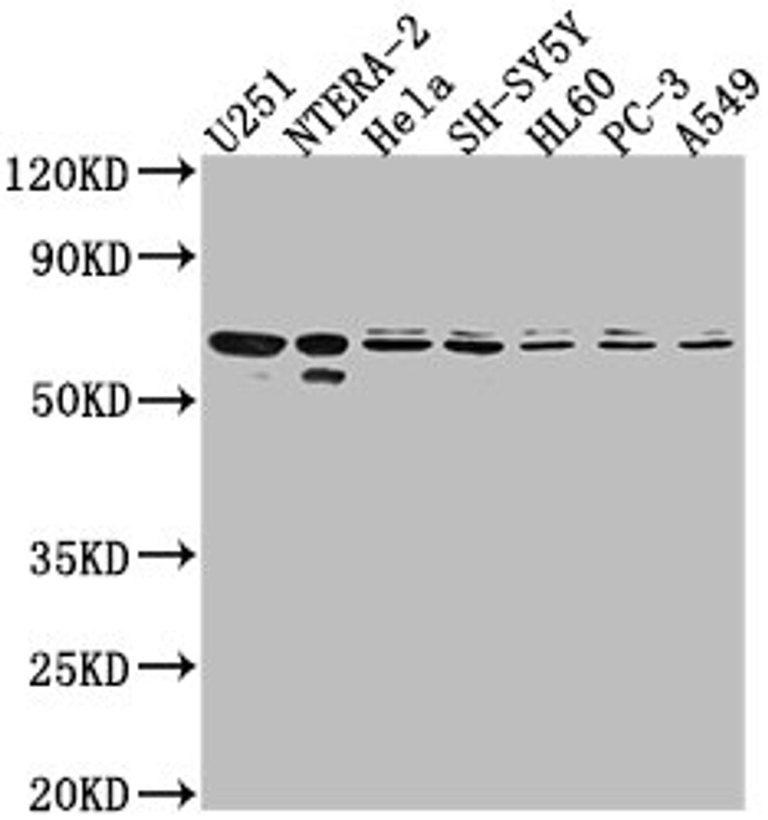 Western Blot. Positive WB detected in: U251 whole cell lysate, NTERA-2 whole cell lysate, Hela whole cell lysate, SH-SY5Y whole cell lysate, HL60 whole cell lysate, PC-3 whole cell lysate, A549 whole cell lysate. All lanes: CDK17 antibody at 1:2000. Secondary. Goat polyclonal to rabbit IgG at 1/50000 dilution. Predicted band size: 60 kDa. Observed band size: 60 kDa.