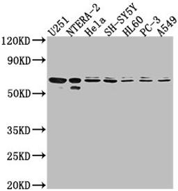 Western Blot. Positive WB detected in: U251 whole cell lysate, NTERA-2 whole cell lysate, Hela whole cell lysate, SH-SY5Y whole cell lysate, HL60 whole cell lysate, PC-3 whole cell lysate, A549 whole cell lysate. All lanes: CDK17 antibody at 1:2000. Secondary. Goat polyclonal to rabbit IgG at 1/50000 dilution. Predicted band size: 60 kDa. Observed band size: 60 kDa.