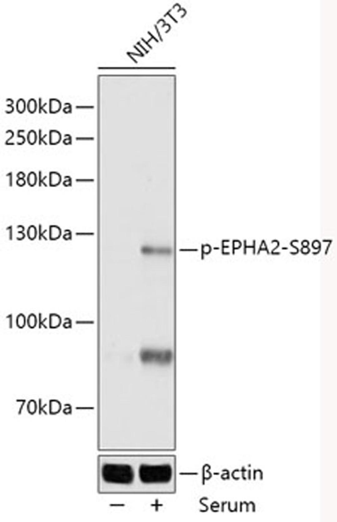 Western blot - Phospho-EPHA2-S897 antibody (AP1082)