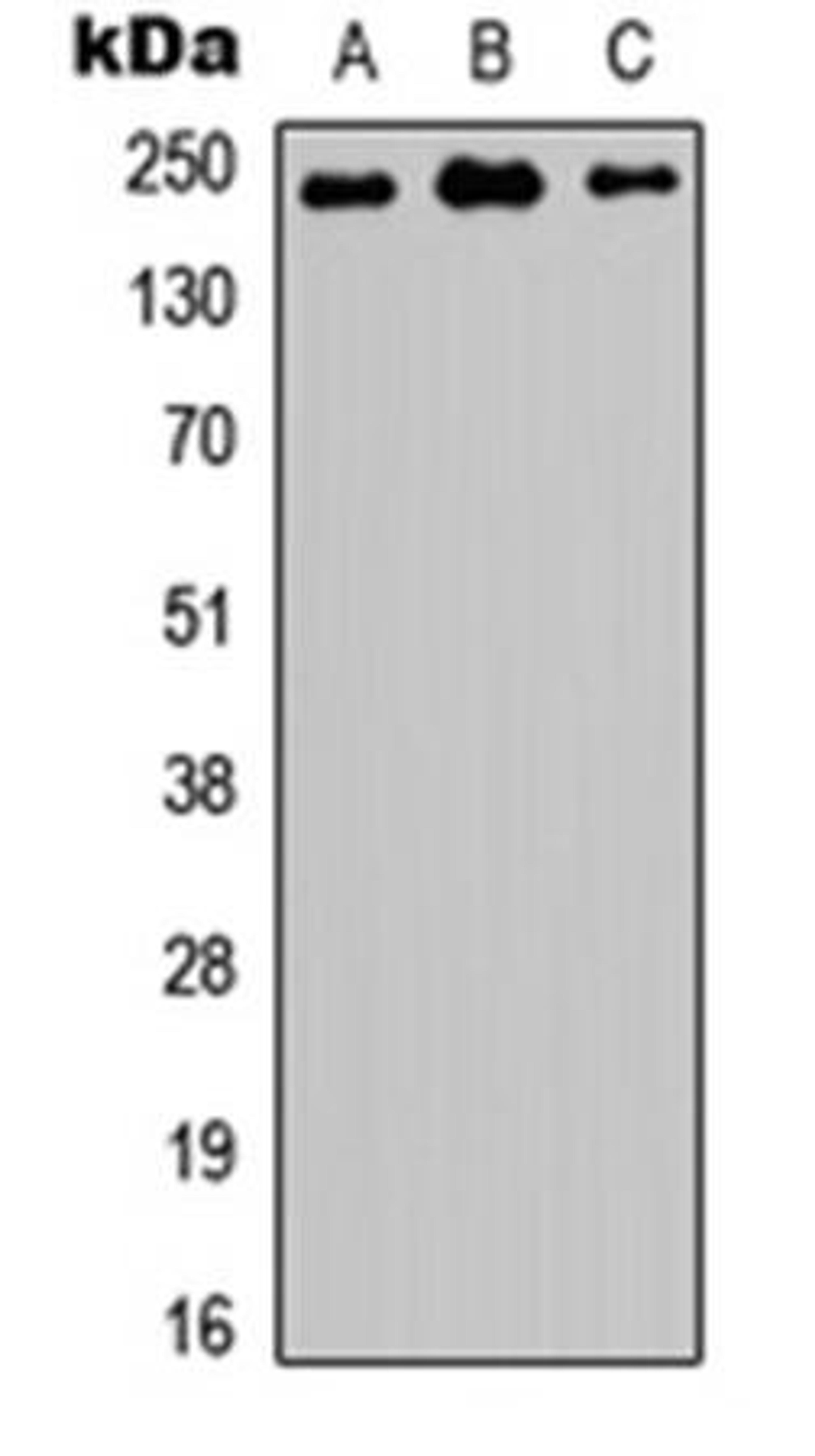 Western blot analysis of HEK293T (Lane1), NS-1 (Lane2), PC12 (Lane3) whole cell using TRAP230 antibody