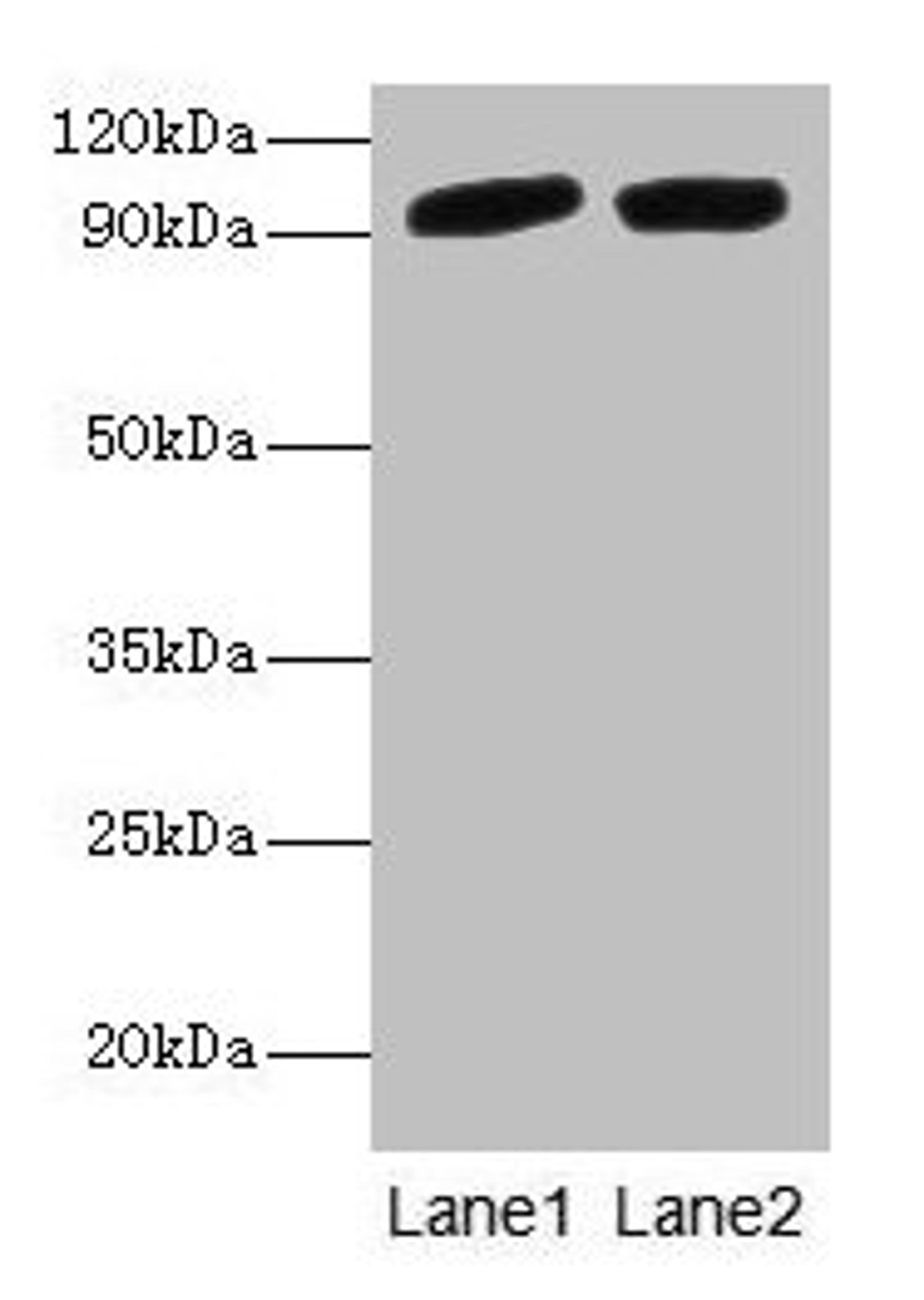 Western blot. All lanes: POSTN antibody at 2µg/ml. Lane 1: Mouse liver tissue. Lane 2: Hela whole cell lysate. Secondary. Goat polyclonal to rabbit IgG at 1/10000 dilution. Predicted band size: 94, 88, 84, 91, 81 kDa. Observed band size: 94 kDa