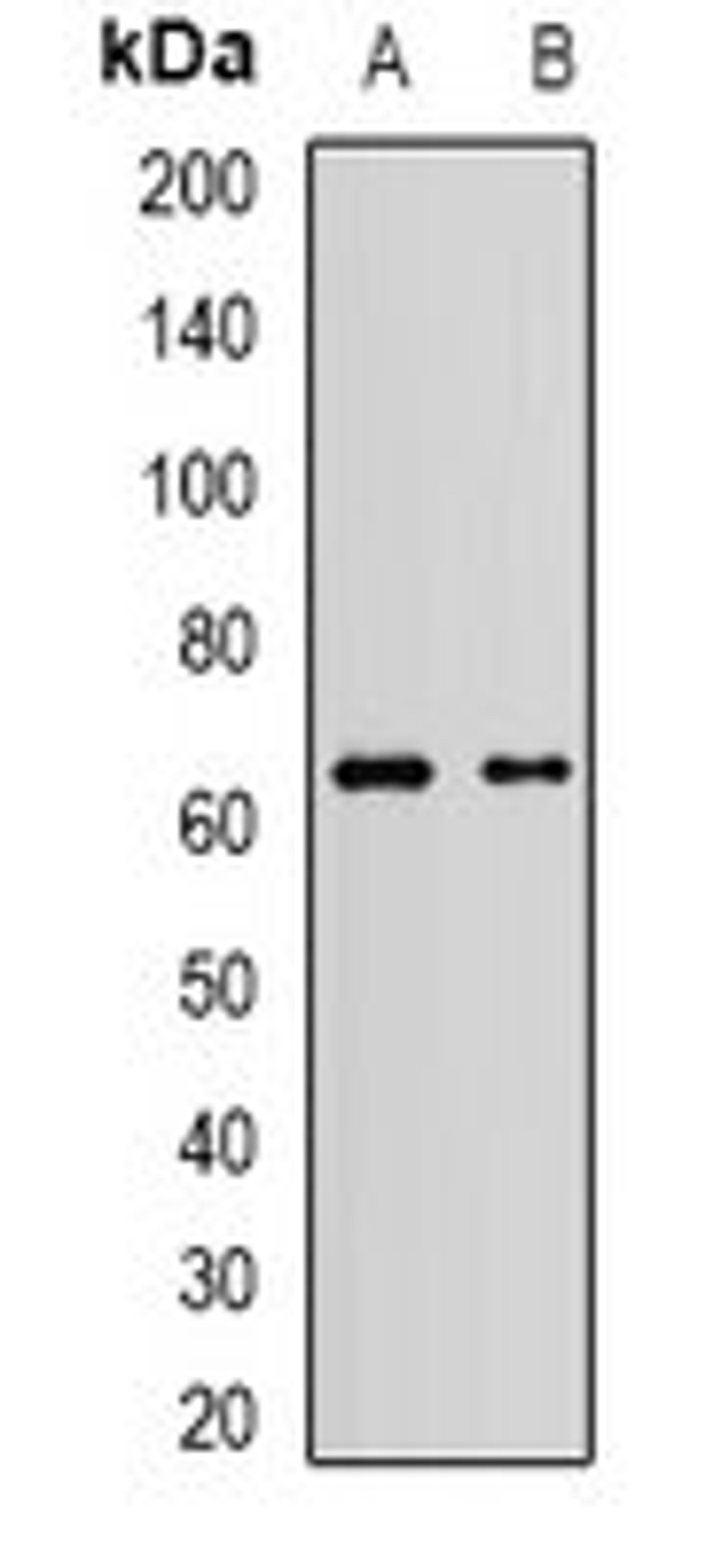 Western blot analysis of Jurkat (Lane1), A549 (Lane2) whole cell lysates using MLLT3 antibody