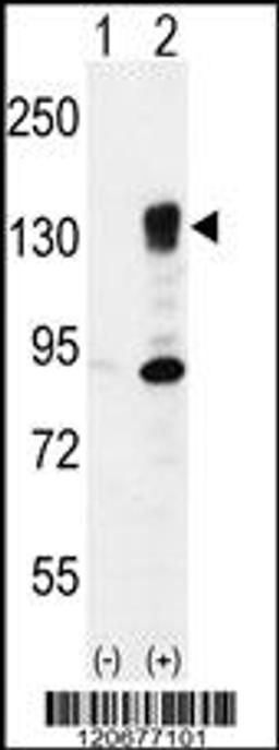 Western blot analysis of ITGA5 using rabbit polyclonal ITGA5 Antibody using 293 cell lysates (2 ug/lane) either nontransfected (Lane 1) or transiently transfected (Lane 2) with the ITGA5 gene.