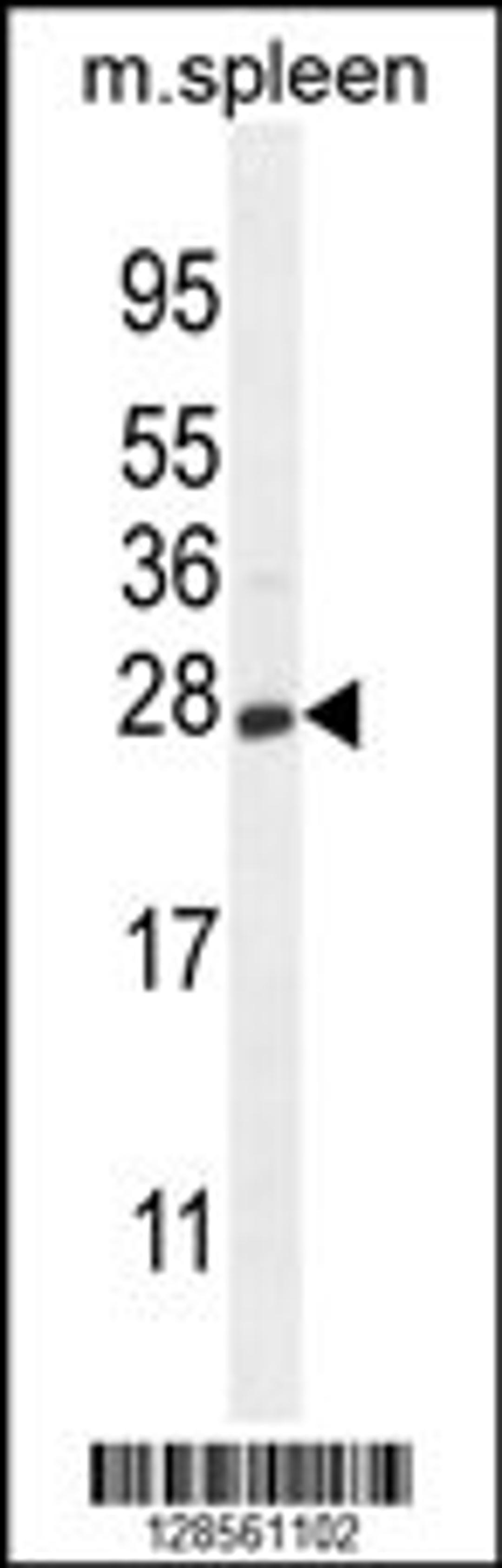 Western blot analysis in mouse spleen tissue lysates (35ug/lane).