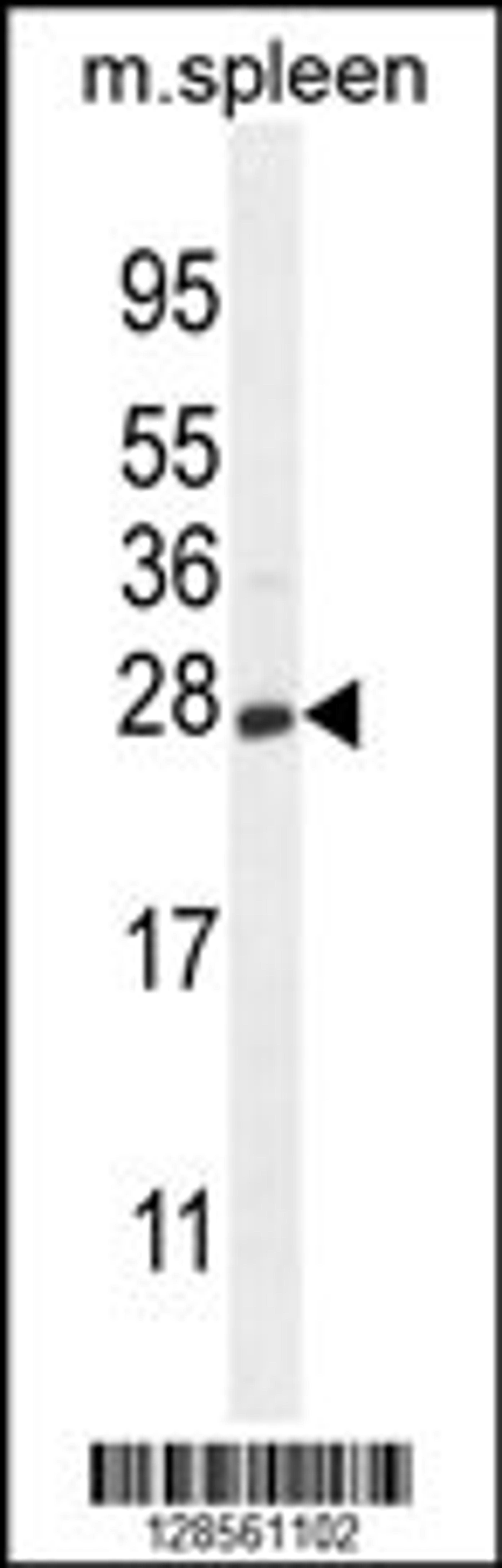 Western blot analysis in mouse spleen tissue lysates (35ug/lane).