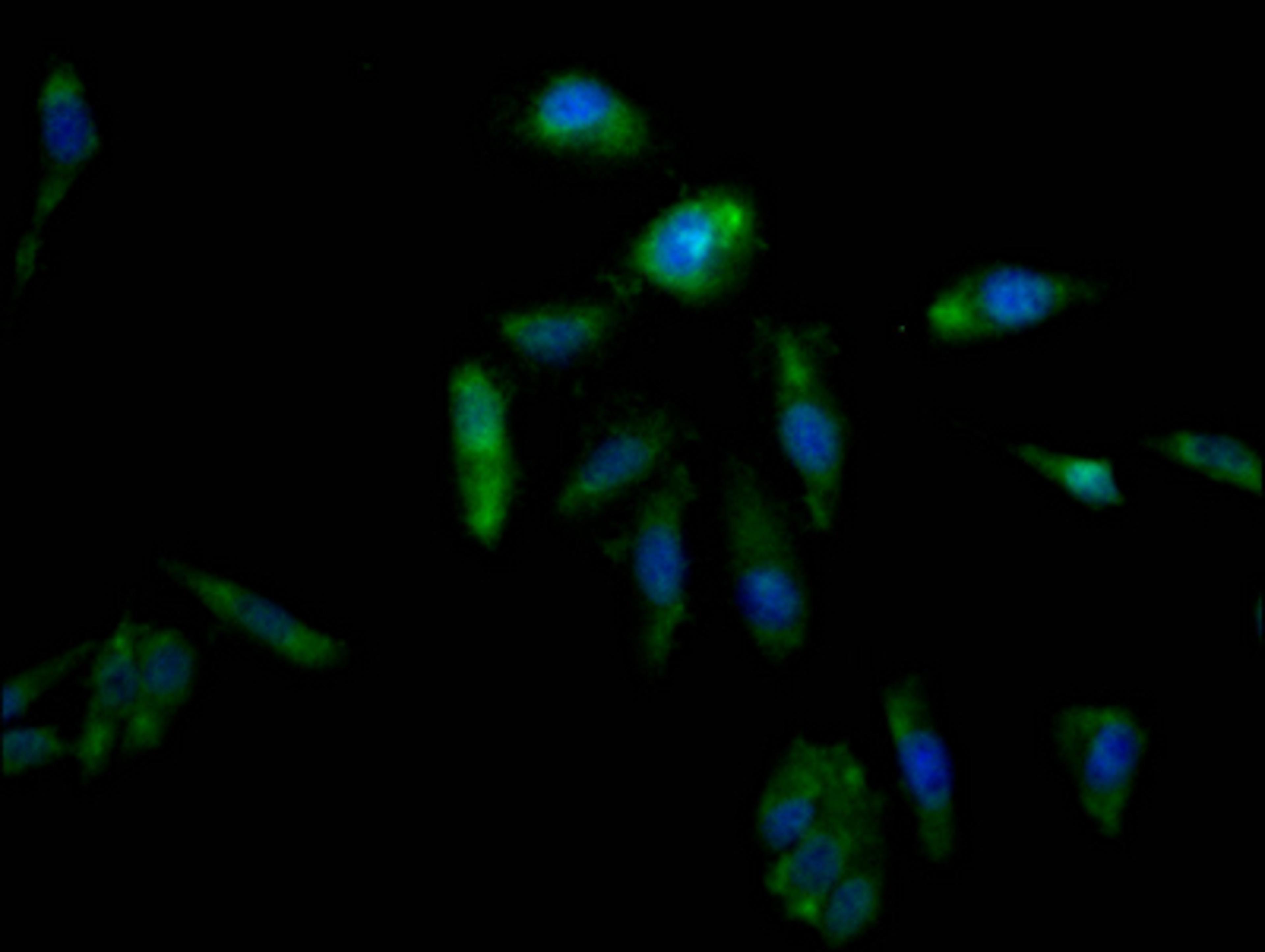 Immunofluorescence staining of Hela Cells with CSB-RA825204A0HU at 1:50, counter-stained with DAPI. The cells were fixed in 4% formaldehyde, permeated by 0.2% TritonX-100, and blocked in 10% normal Goat Serum. The cells were then incubated with the antibody overnight at 4℃. Nuclear DNA was labeled in blue with DAPI. The secondary antibody was FITC-conjugated AffiniPure Goat Anti-Rabbit IgG (H+L).