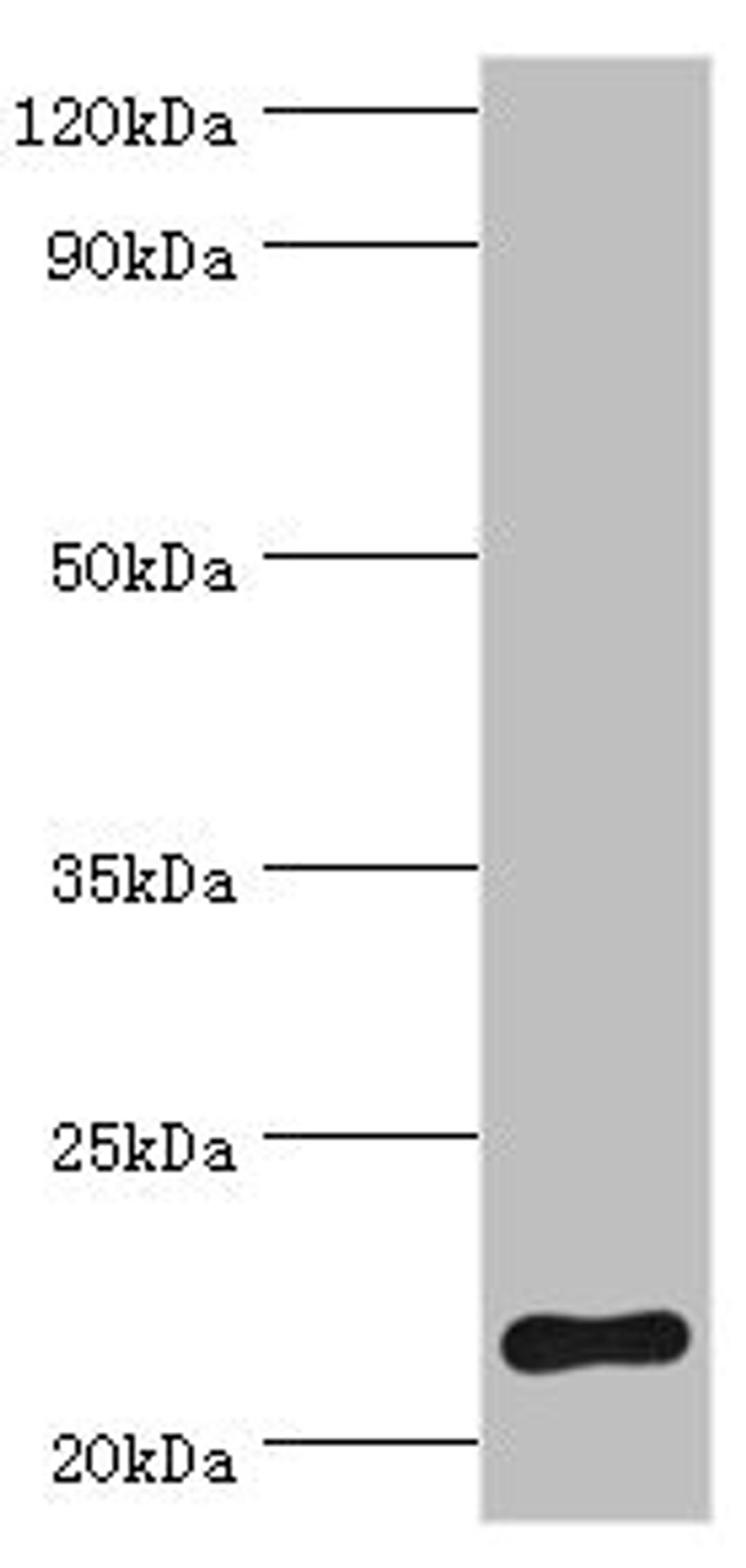 Western blot. All lanes: Suppressor of cytokine signaling 2 antibody at 2ug/ml + HepG2 whole cell lysate. Secondary. Goat polyclonal to rabbit IgG at 1/10000 dilution. Predicted band size: 22 kDa. Observed band size: 22 kDa. 