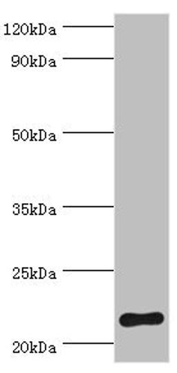 Western blot. All lanes: Suppressor of cytokine signaling 2 antibody at 2ug/ml + HepG2 whole cell lysate. Secondary. Goat polyclonal to rabbit IgG at 1/10000 dilution. Predicted band size: 22 kDa. Observed band size: 22 kDa. 