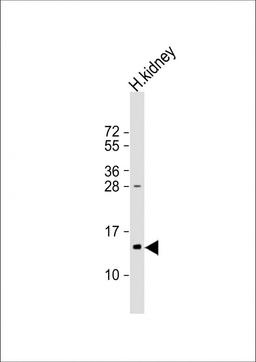 Western Blot at 1:1000 dilution + human kidney lysate Lysates/proteins at 20 ug per lane.