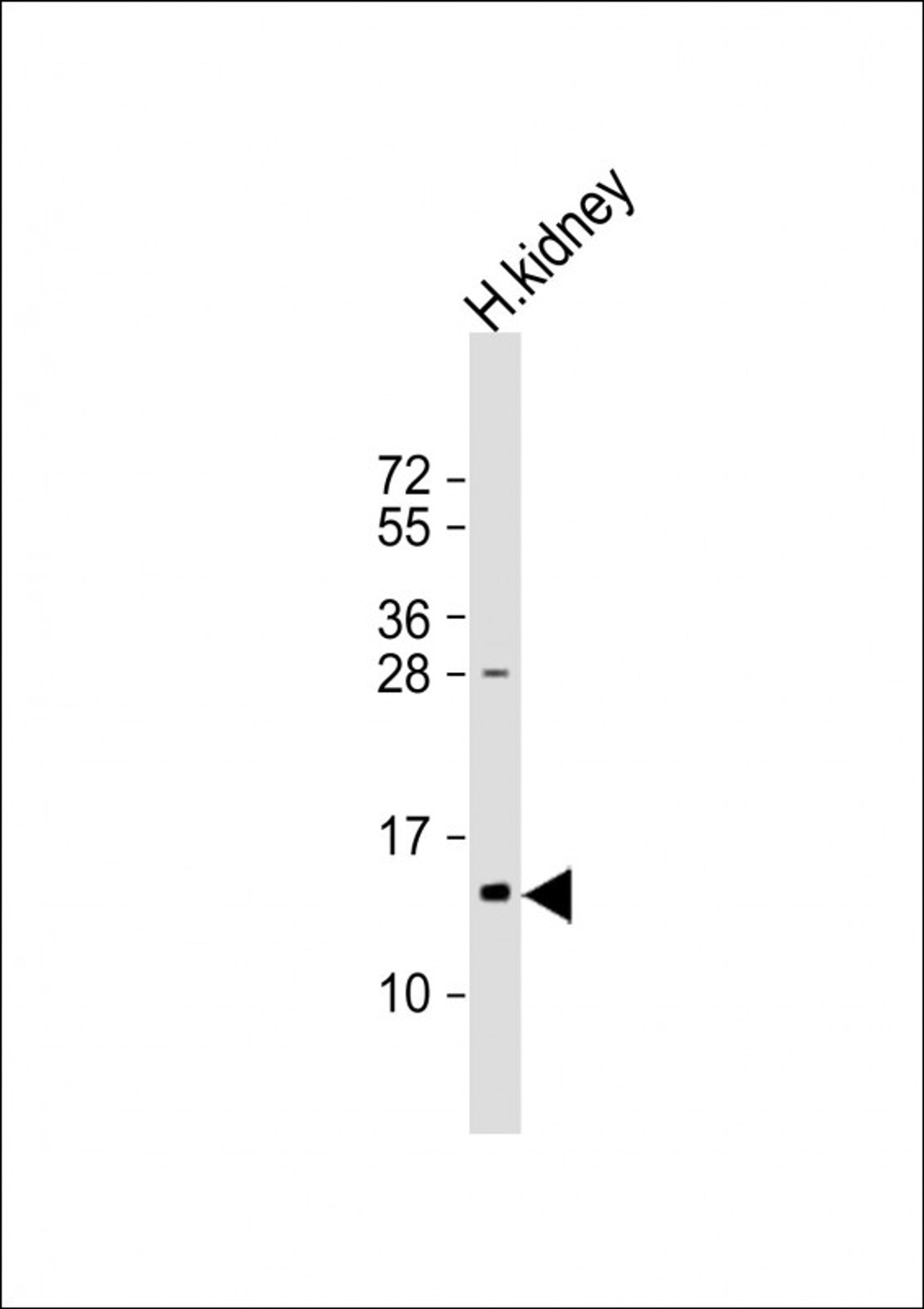 Western Blot at 1:1000 dilution + human kidney lysate Lysates/proteins at 20 ug per lane.