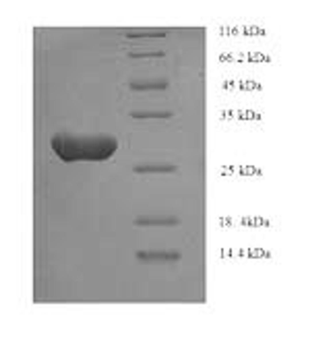 (Tris-Glycine gel) Discontinuous SDS-PAGE (reduced) with 5% enrichment gel and 15% separation gel.