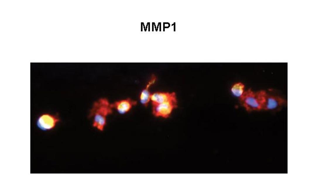 Antibody used in IHC on Human Macrophage at 1:200.