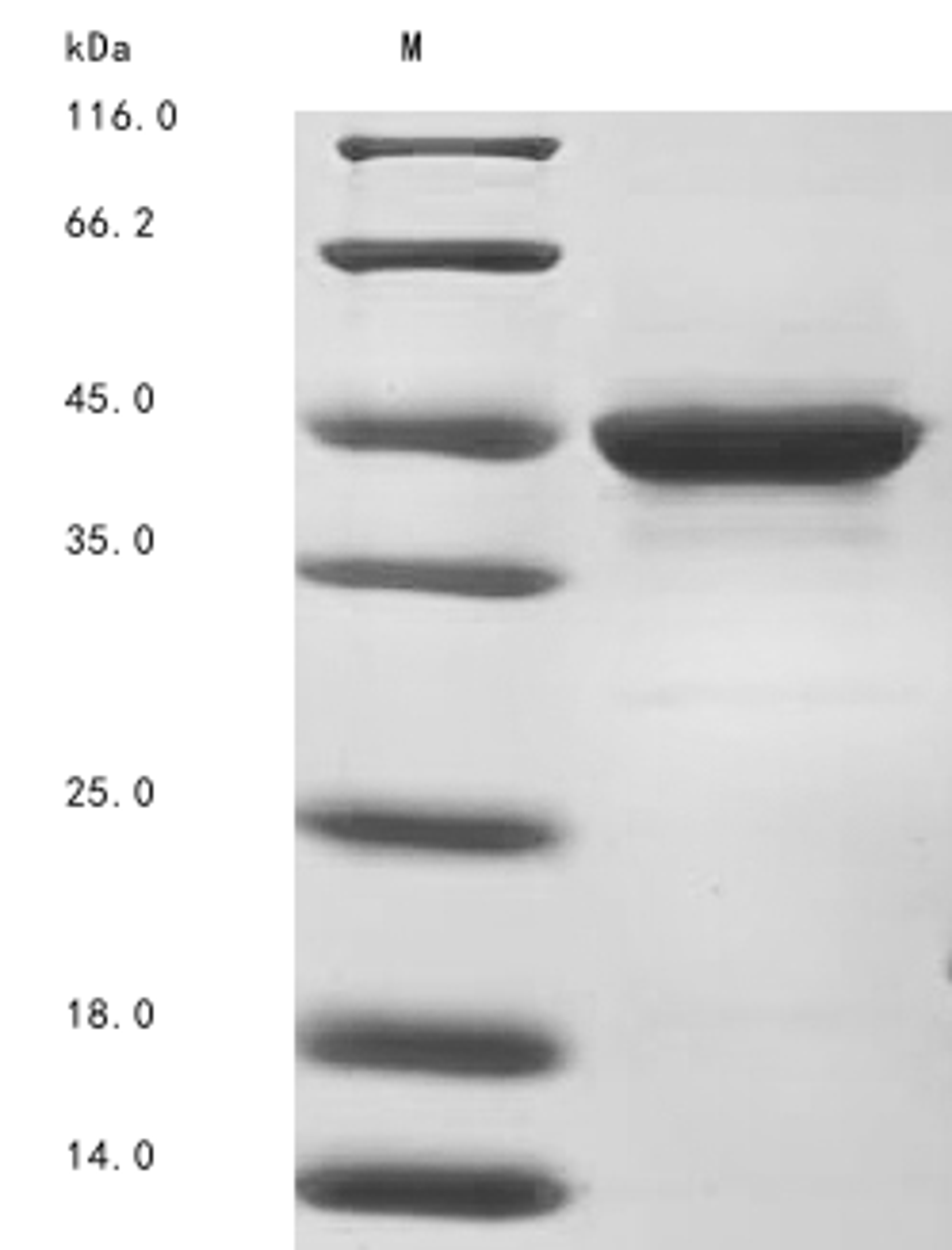 (Tris-Glycine gel) Discontinuous SDS-PAGE (reduced) with 5% enrichment gel and 15% separation gel.