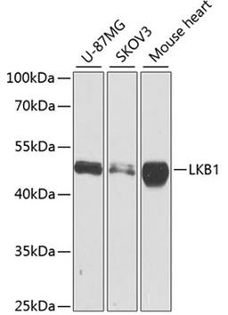 Western blot - LKB1 antibody (A2122)