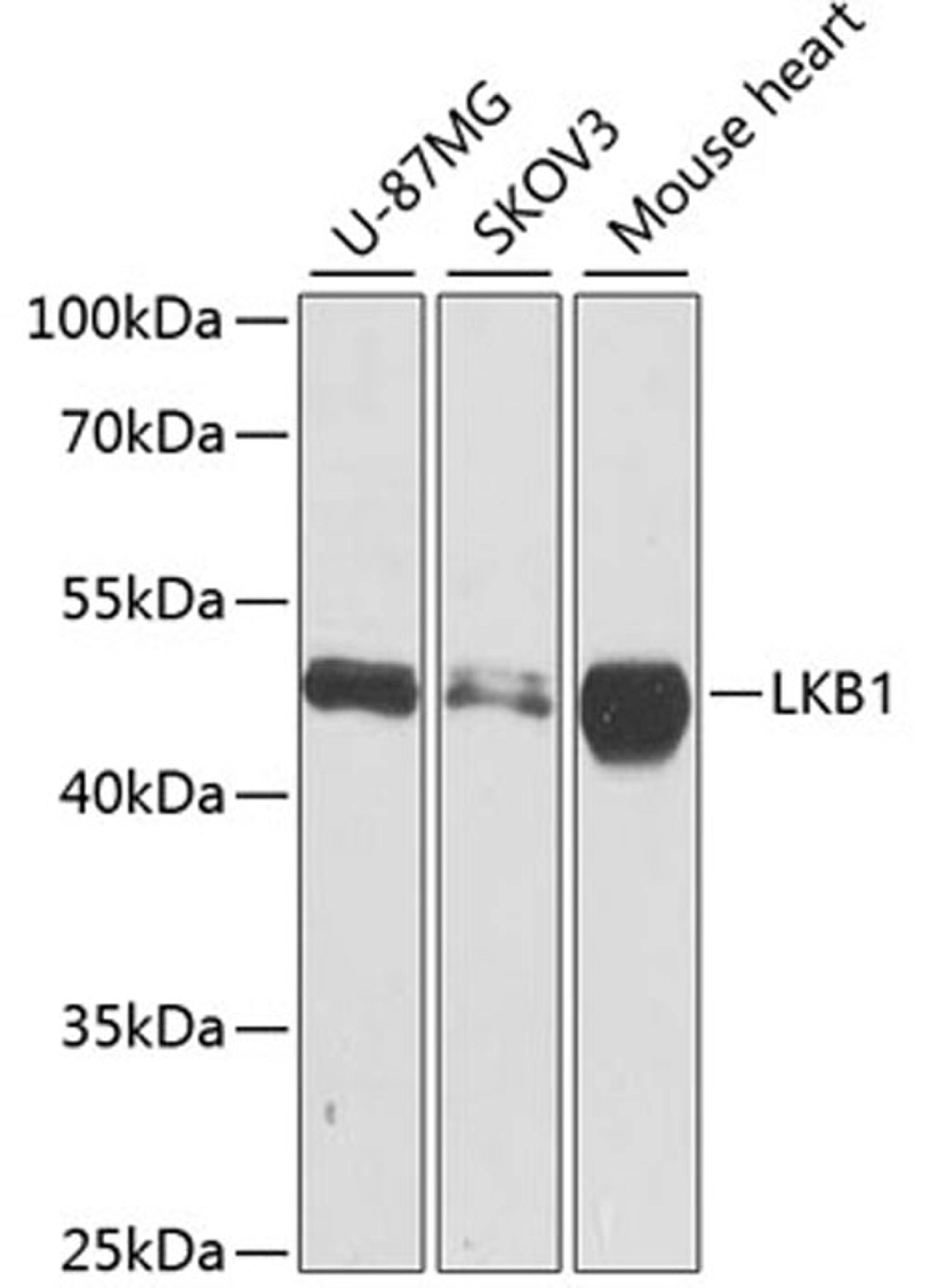 Western blot - LKB1 antibody (A2122)