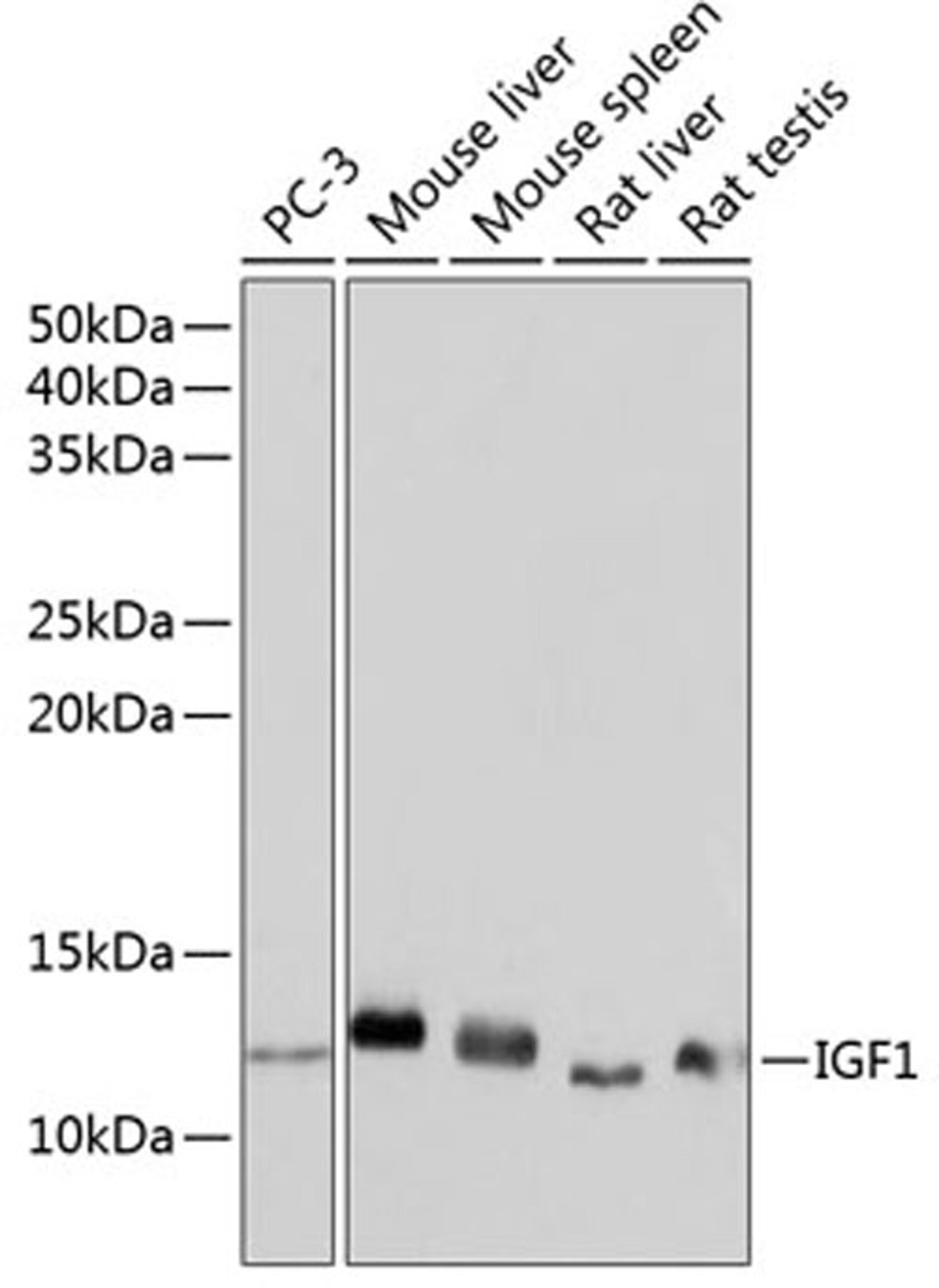 Western blot - IGF1 Rabbit mAb (A0830)