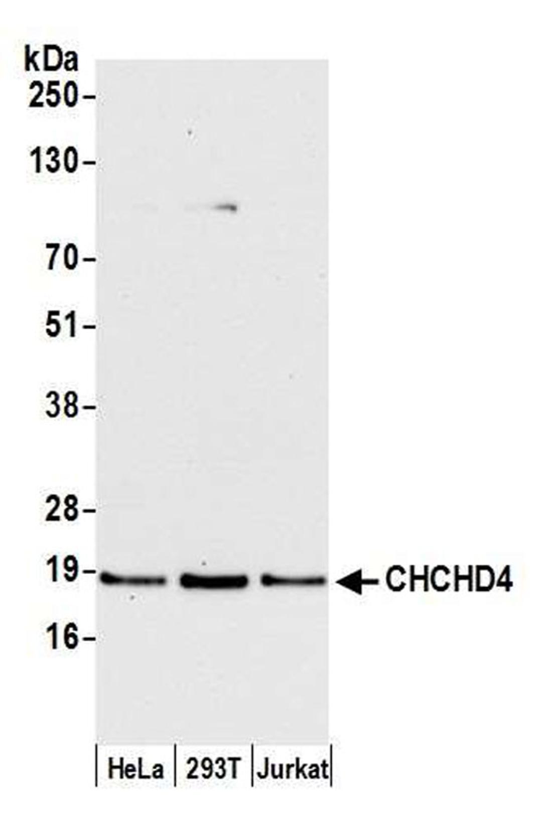 Detection of human CHCHD4 by WB.