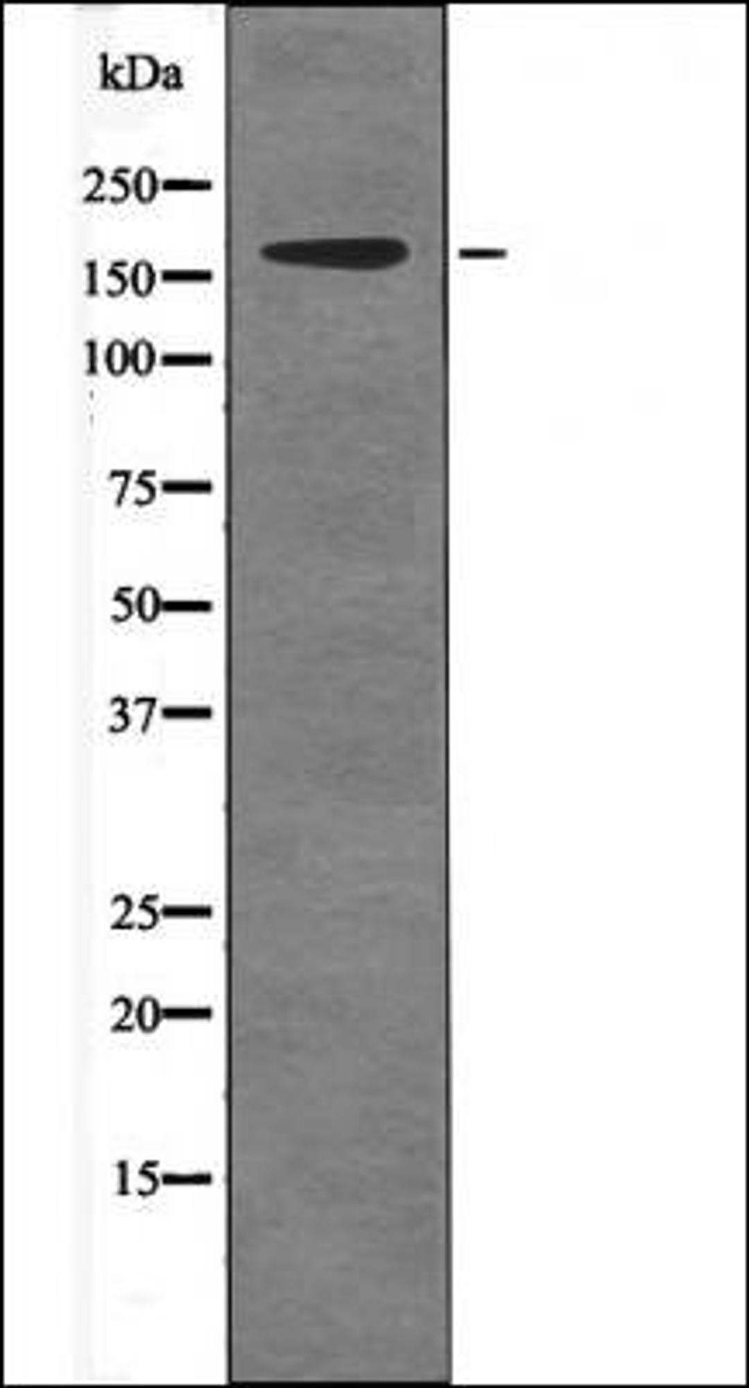 Western blot analysis of EGF treated A431 whole cell lysates using c-Ret -Phospho-Tyr981- antibody