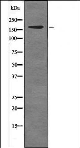 Western blot analysis of EGF treated A431 whole cell lysates using c-Ret -Phospho-Tyr981- antibody