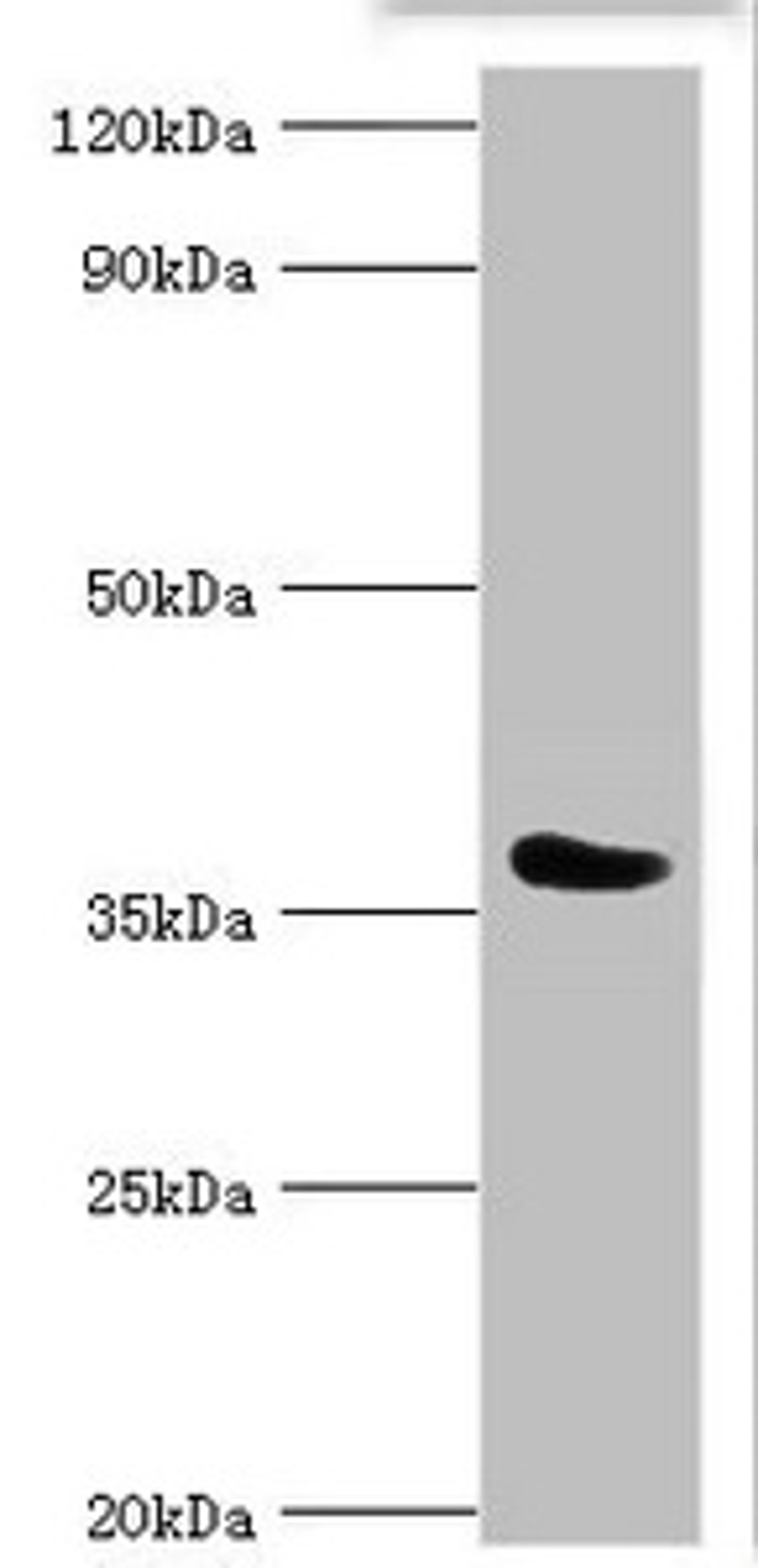 Western blot. All lanes: SLAM family member 5 antibody at 6ug/ml + Mouse liver tissue. Secondary. Goat polyclonal to rabbit IgG at 1/10000 dilution. Predicted band size: 39, 37, 32, 31, 27, 25 kDa. Observed band size: 39 kDa. 