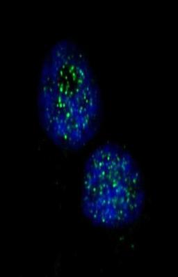 Immunocytochemistry/Immunofluorescence: Chk1 Antibody [NB100-464] - NBF-fixed HeLa cells treated with neocarzinostatin. Antibody used at a dilution of 1:1,000 (1ug/ml) .