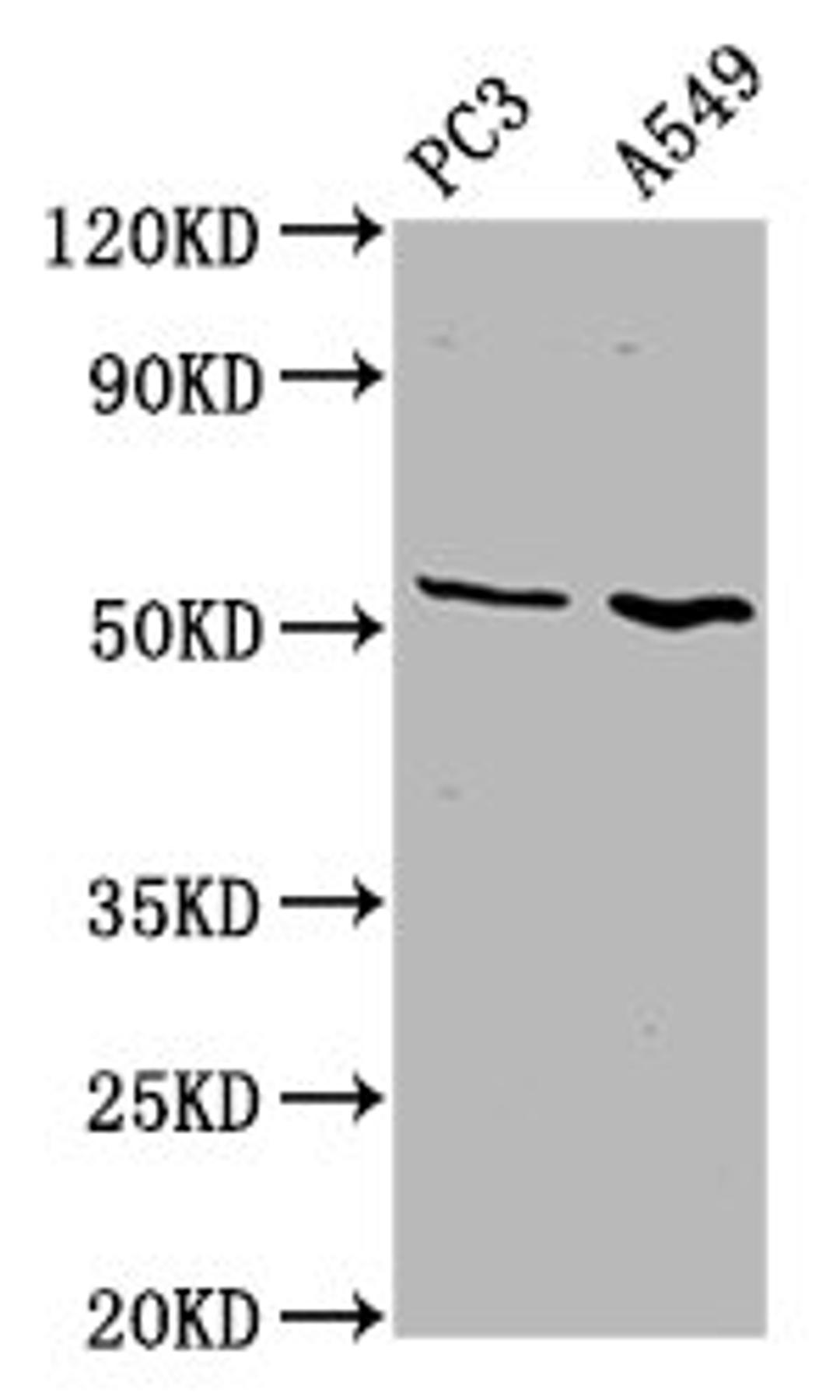 Western Blot. Positive WB detected in: PC-3 whole cell lysate, A549 whole cell lysate. All lanes: ETV5 antibody at 4.6µg/ml. Secondary. Goat polyclonal to rabbit IgG at 1/50000 dilution. Predicted band size: 58, 63 kDa. Observed band size: 58 kDa