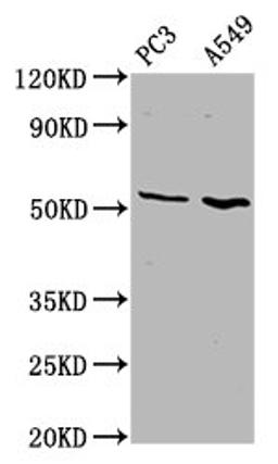 Western Blot. Positive WB detected in: PC-3 whole cell lysate, A549 whole cell lysate. All lanes: ETV5 antibody at 4.6µg/ml. Secondary. Goat polyclonal to rabbit IgG at 1/50000 dilution. Predicted band size: 58, 63 kDa. Observed band size: 58 kDa