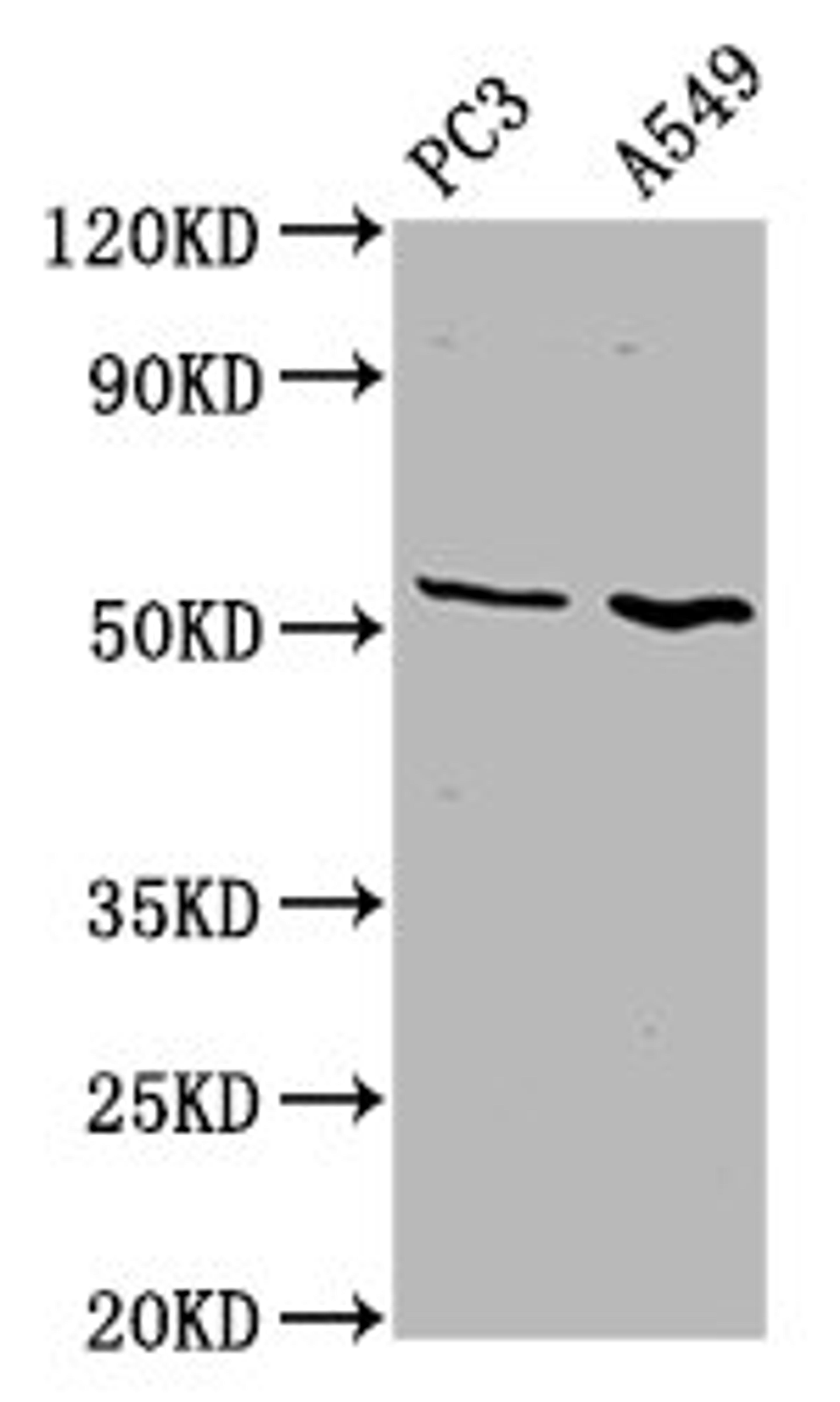 Western Blot. Positive WB detected in: PC-3 whole cell lysate, A549 whole cell lysate. All lanes: ETV5 antibody at 4.6µg/ml. Secondary. Goat polyclonal to rabbit IgG at 1/50000 dilution. Predicted band size: 58, 63 kDa. Observed band size: 58 kDa
