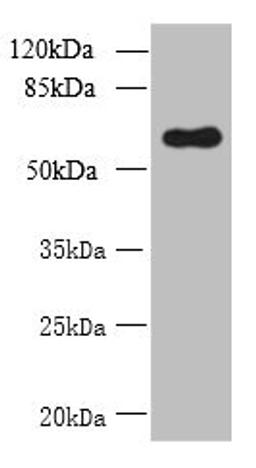 Western blot. All lanes: GDPD2 antibody at 1.5µg/ml + A431 whole cell lysate. Secondary. Goat polyclonal to rabbit IgG at 1/10000 dilution. Predicted band size: 62, 53, 67 kDa. Observed band size: 62 kDa
