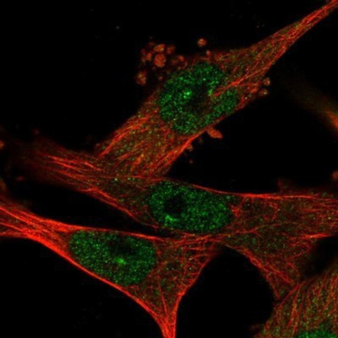 Immunocytochemistry/Immunofluorescence: WDR68 Antibody [NBP1-92589] - Staining of human cell line U-251MG shows positivity in nucleus but not nucleoli & cytoplasm.