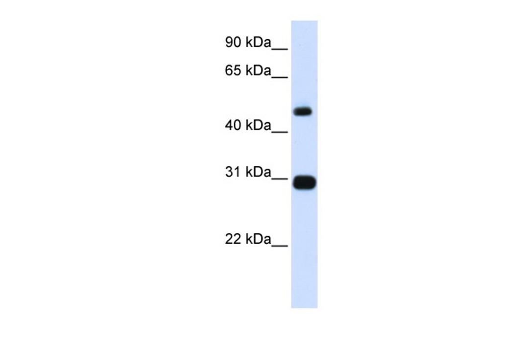 Antibody used in WB on Human Placenta at 0.2-1 ug/ml.