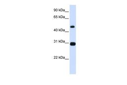 Antibody used in WB on Human Placenta at 0.2-1 ug/ml.