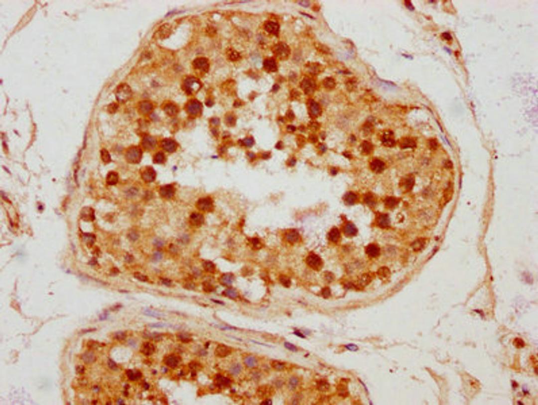 IHC image of CSB-PA688972LA01HU diluted at 1:300 and staining in paraffin-embedded human testis tissue performed on a Leica BondTM system. After dewaxing and hydration, antigen retrieval was mediated by high pressure in a citrate buffer (pH 6.0). Section was blocked with 10% normal goat serum 30min at RT. Then primary antibody (1% BSA) was incubated at 4°C overnight. The primary is detected by a biotinylated secondary antibody and visualized using an HRP conjugated SP system.