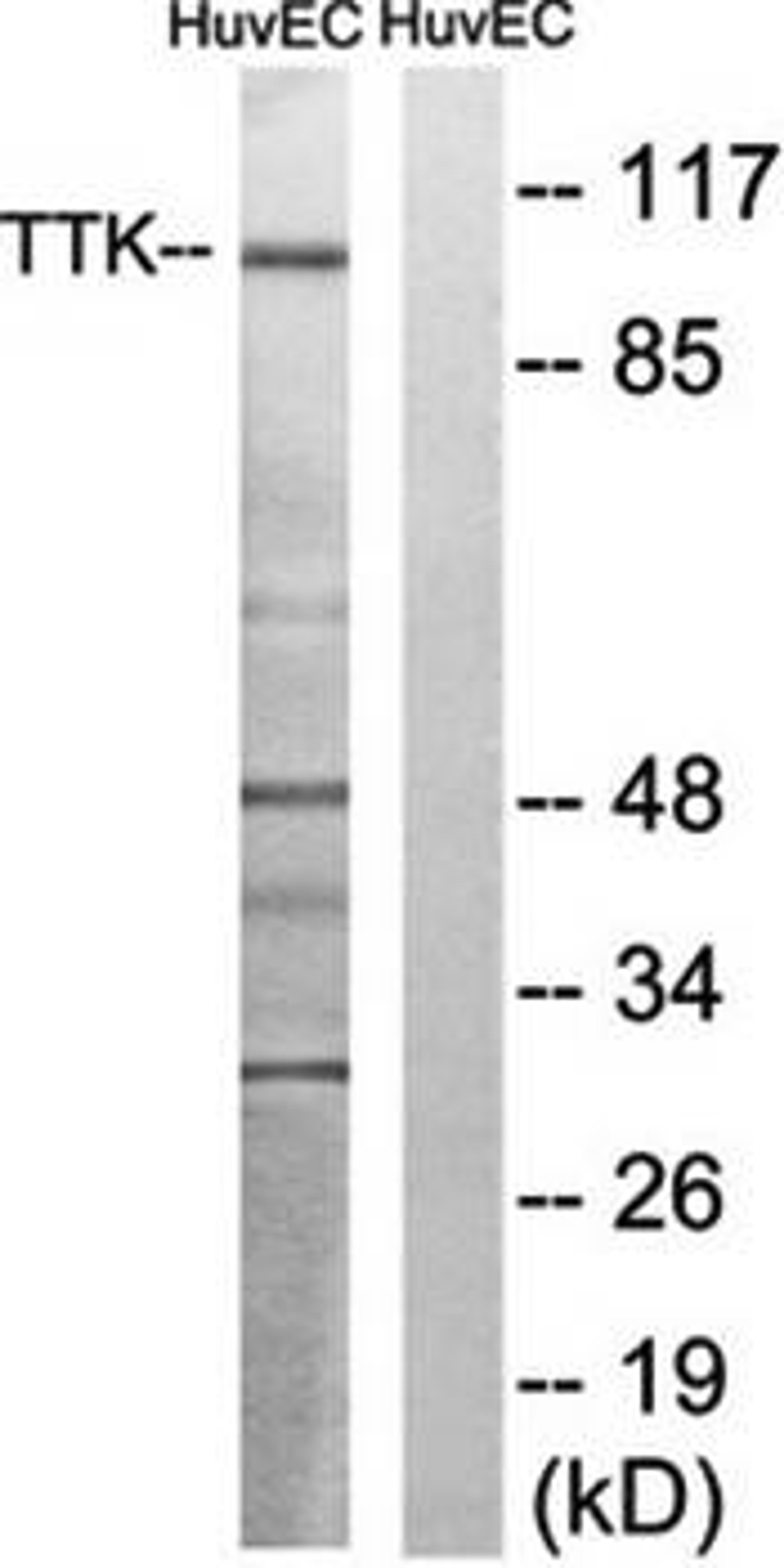 Western blot analysis of extracts from HUVEC cells using TTK antibody