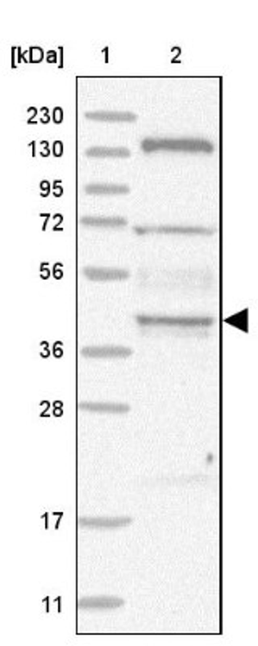 Western Blot: SDCCAG3 Antibody [NBP1-82507] - Lane 1: Marker [kDa] 230, 130, 95, 72, 56, 36, 28, 17, 11<br/>Lane 2: Human cell line RT-4