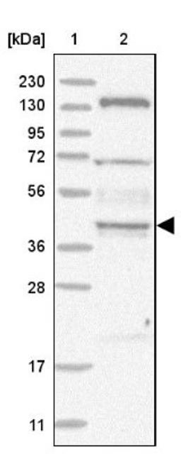 Western Blot: SDCCAG3 Antibody [NBP1-82507] - Lane 1: Marker [kDa] 230, 130, 95, 72, 56, 36, 28, 17, 11<br/>Lane 2: Human cell line RT-4