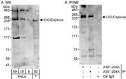 Detection of human CIC/Capicua by western blot and immunoprecipitation.