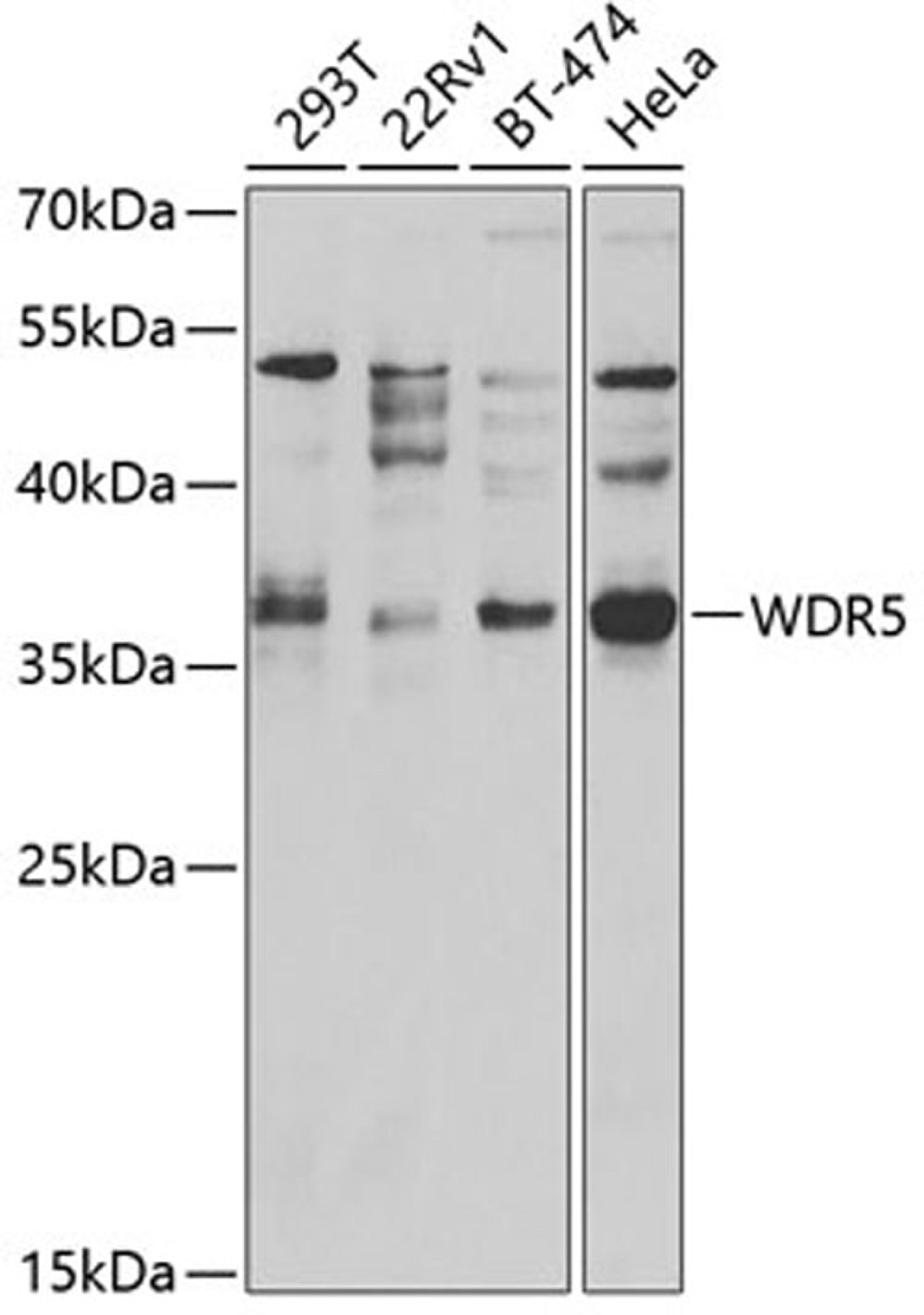 Western blot - WDR5 antibody (A2023)