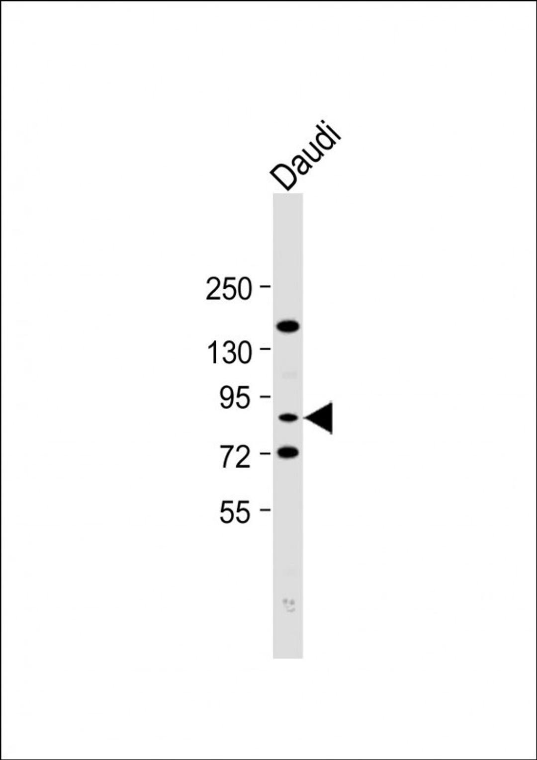 Western Blot at 1:2000 dilution + Daudi whole cell lysate Lysates/proteins at 20 ug per lane.