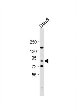 Western Blot at 1:2000 dilution + Daudi whole cell lysate Lysates/proteins at 20 ug per lane.