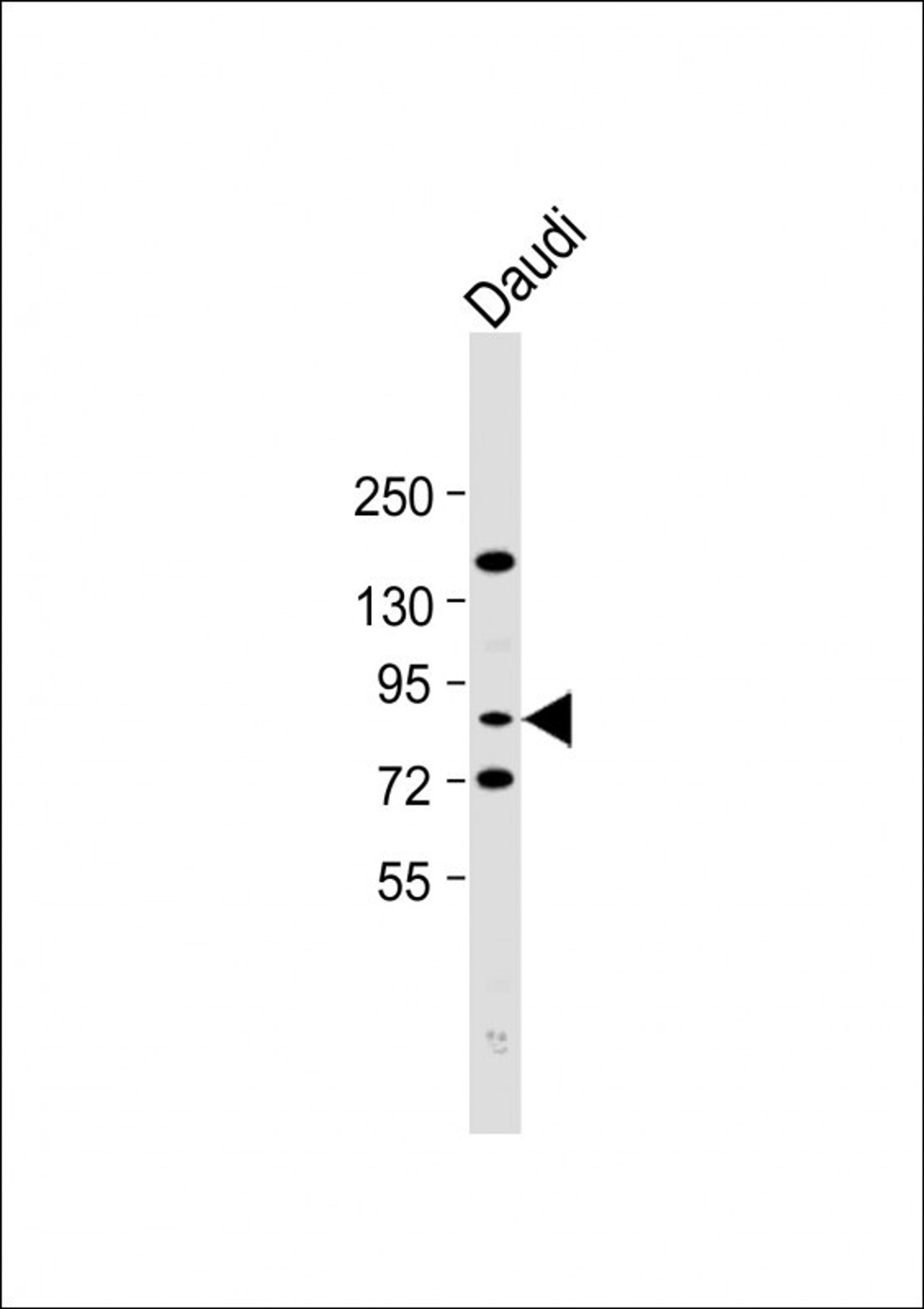 Western Blot at 1:2000 dilution + Daudi whole cell lysate Lysates/proteins at 20 ug per lane.