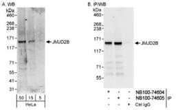 Western Blot: JMJD2B Antibody [NB100-74605] - Detection of Human JMJD2B on HeLa whole cell lysate using NB100-74605. JMJD2B was also  immunoprecipitated by rabbit anti-JMJD2B antibody NB100-74604.