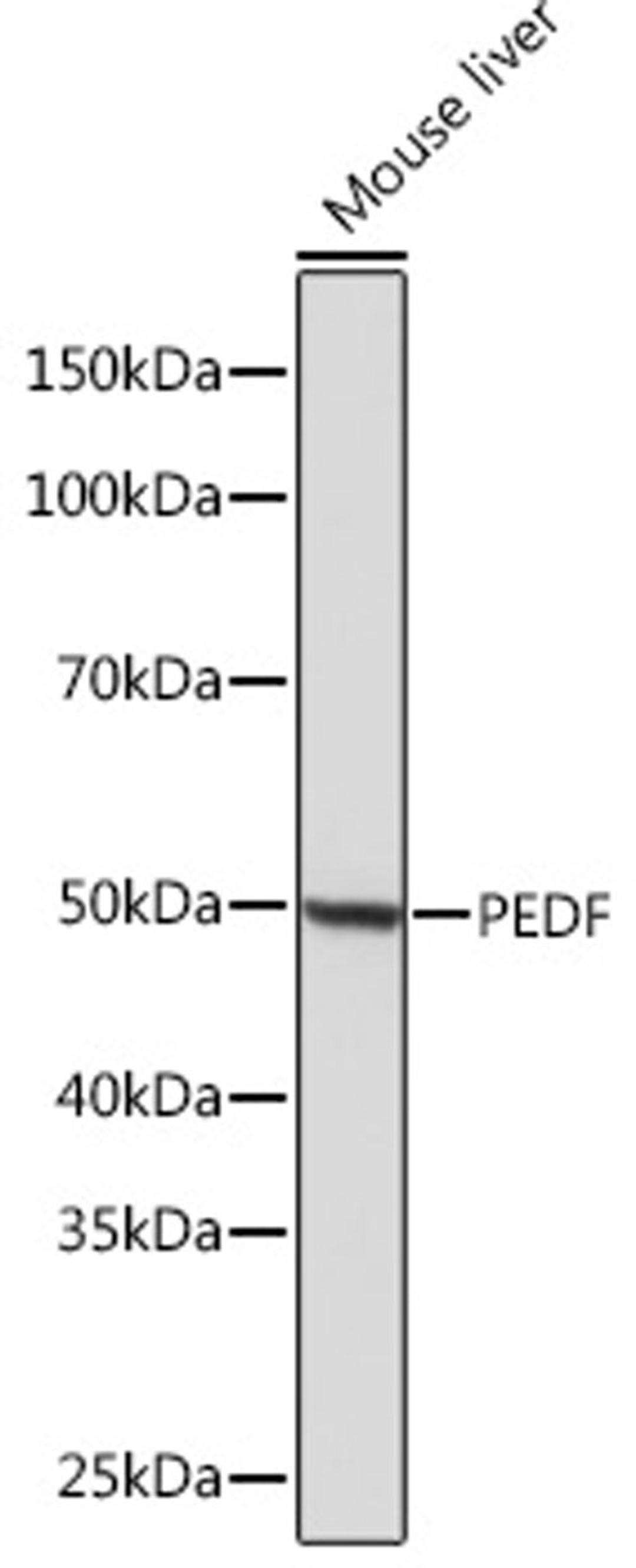 Western blot - PEDF Rabbit mAb (A3475)