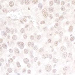 Detection of mouse hPrp3p by immunohistochemistry.