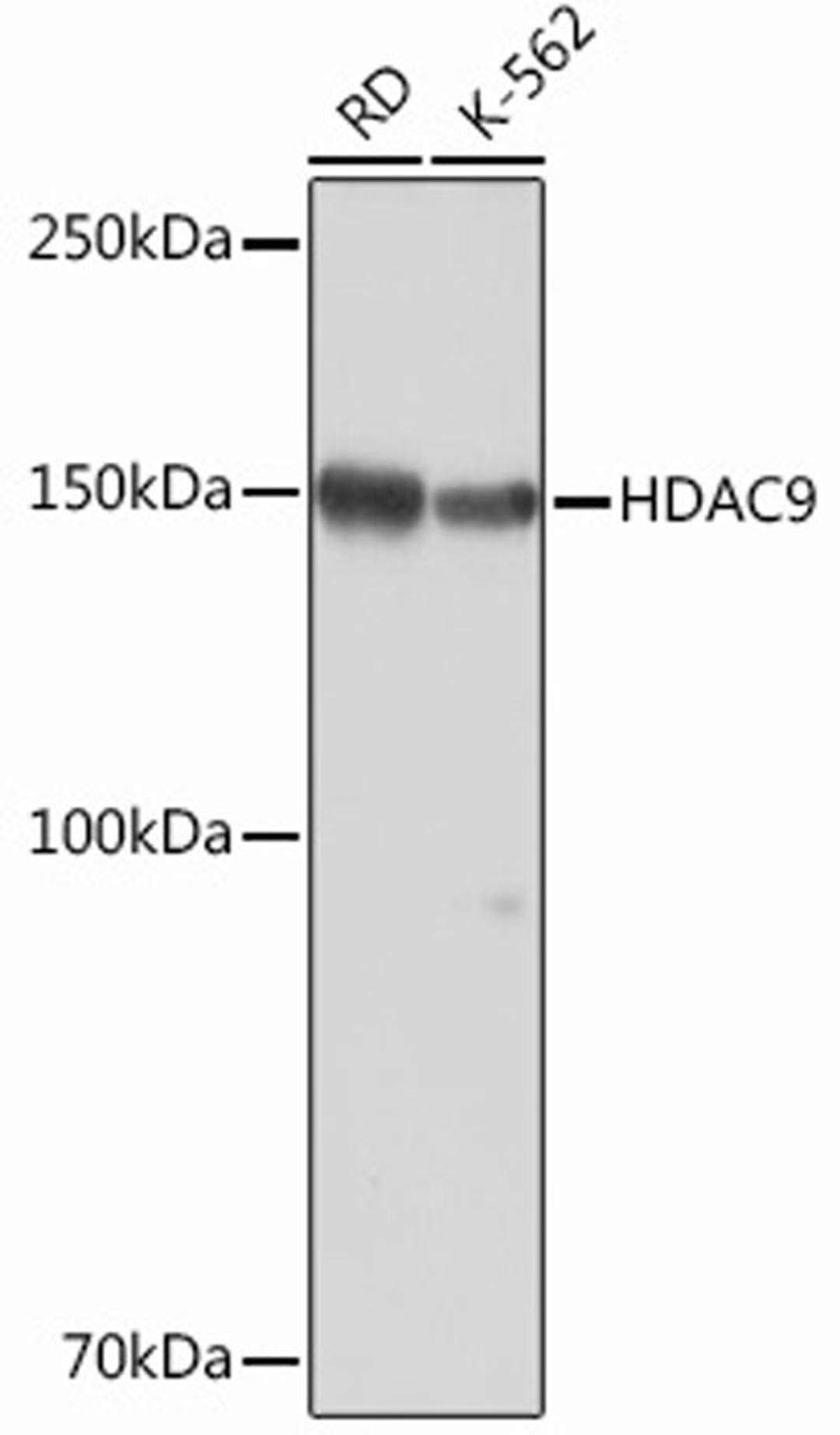 Western blot - HDAC9 Rabbit mAb (A2226)