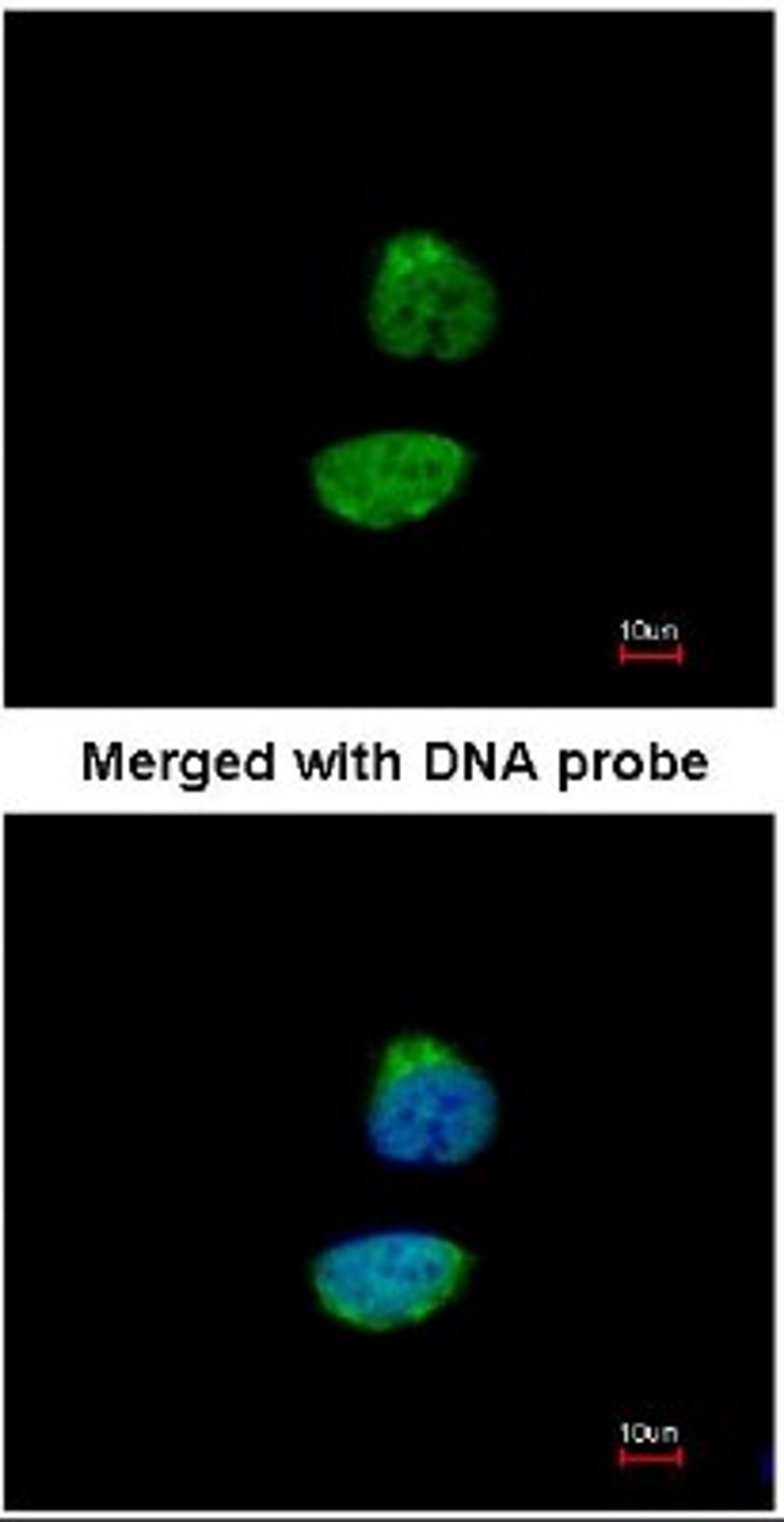 Immunocytochemistry/Immunofluorescence: Cyclin A2 Antibody [NBP1-31330] - Analysis of HeLa, using NBP1-31330 antibody at 1:200 dilution.