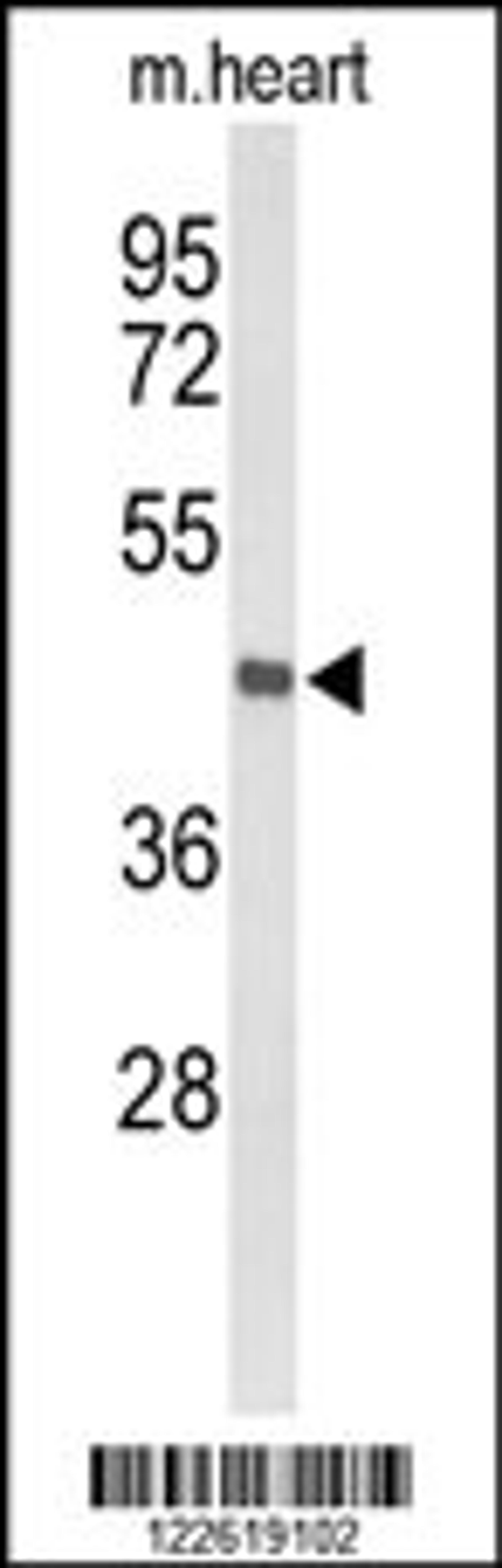 Western blot analysis of DBC1 Antibody in mouse heart tissue lysates (35ug/lane)